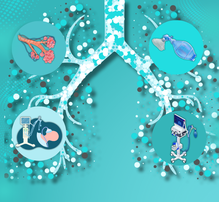 Unveiling the Mysteries of Mechanical Ventilation